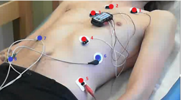 Impedance Cardiography at Higher Frequencies