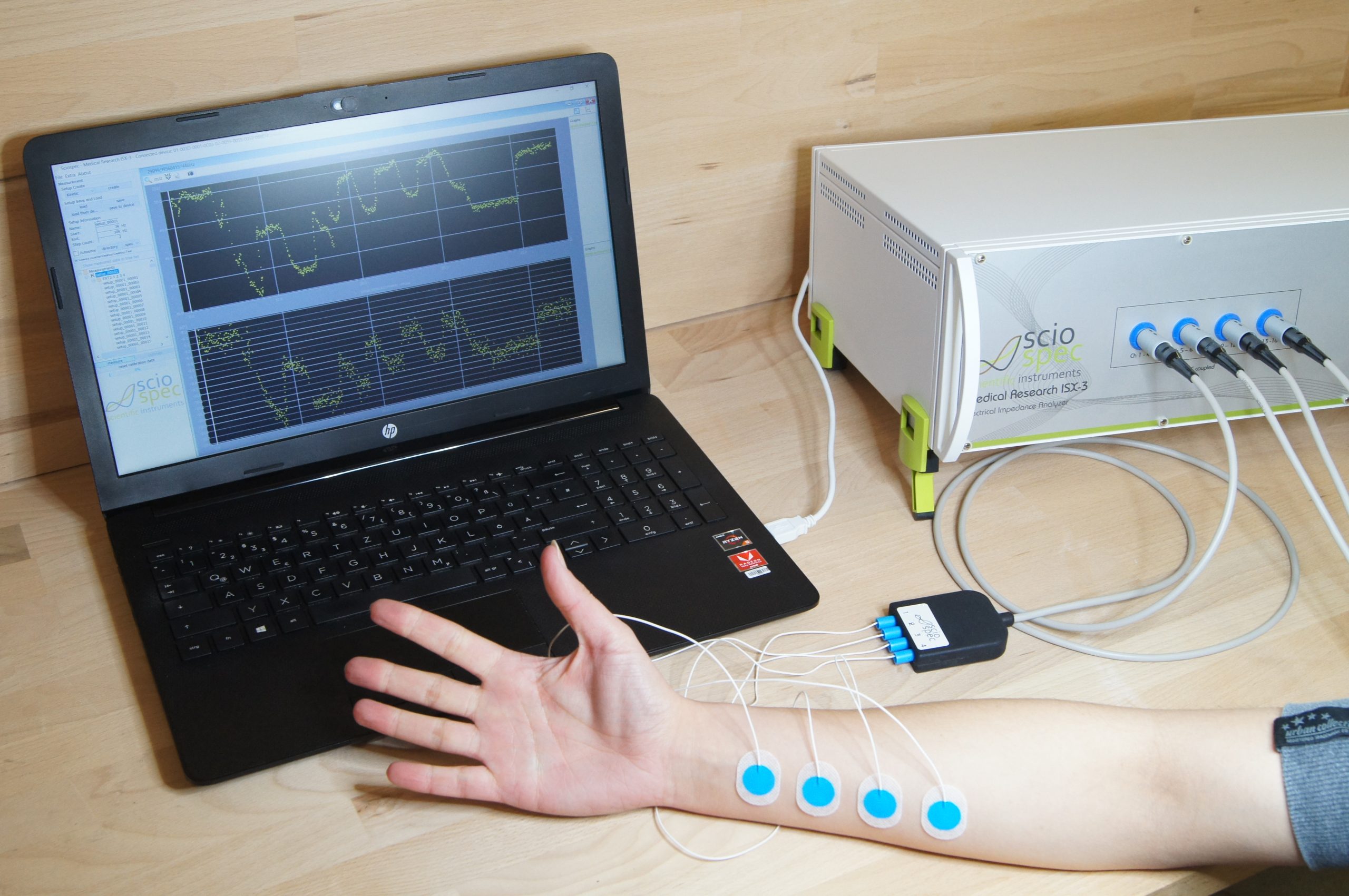 Impedance measurement of a forearm with the Sciospec Medical Research ISX-3 impedance analyzer